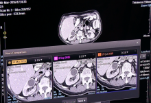 Medical Imaging Technology Scope, Salary, Courses, Jobs In Pakistan