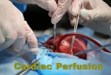 Cardiac Perfusion In Pakistan 5 Cardiac Perfusion In Pakistan Scope, Jobs, Salary, Subjects, Universities